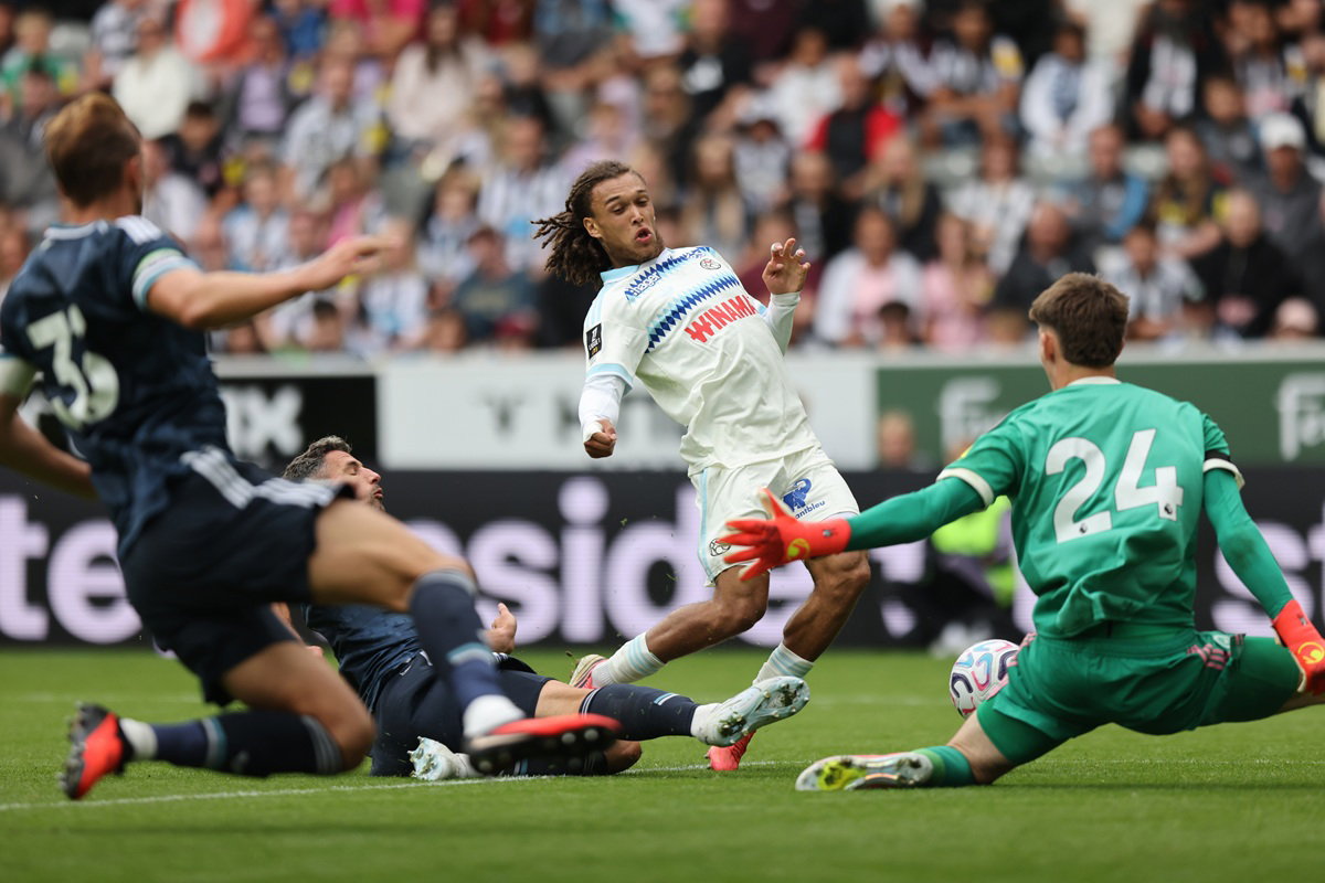 Newcastle United Star Has Picked Up 3rd Injury Since Joining The Club In July